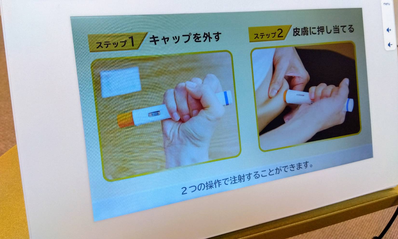 医療DXがテリボン皮下注への恐怖を払拭